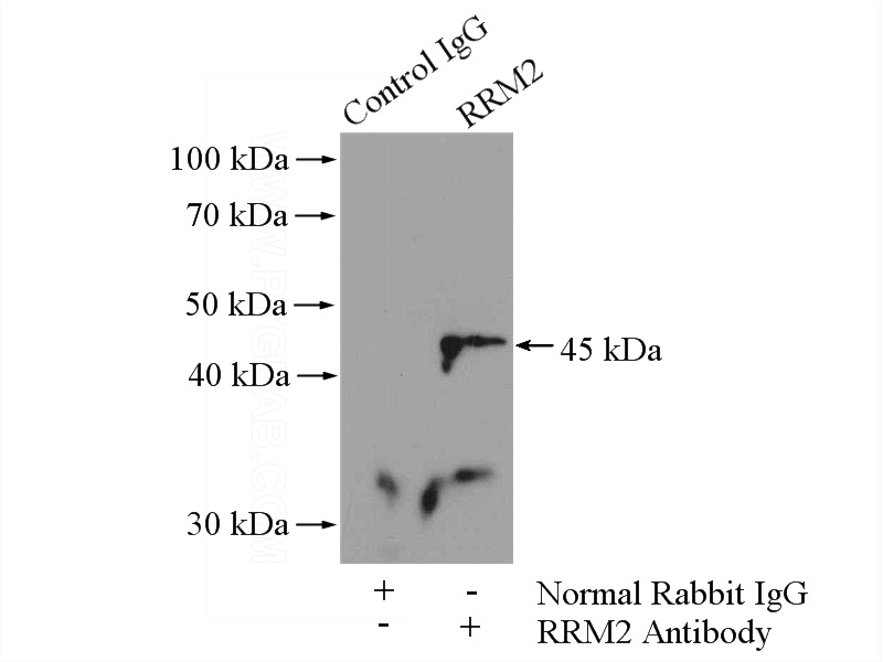 IP Result of anti-RRM2 (IP:Catalog No:114925, 4ug; Detection:Catalog No:114925 1:500) with K-562 cells lysate 1200ug.