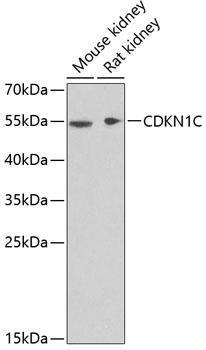Western blot - CDKN1C Polyclonal Antibody 