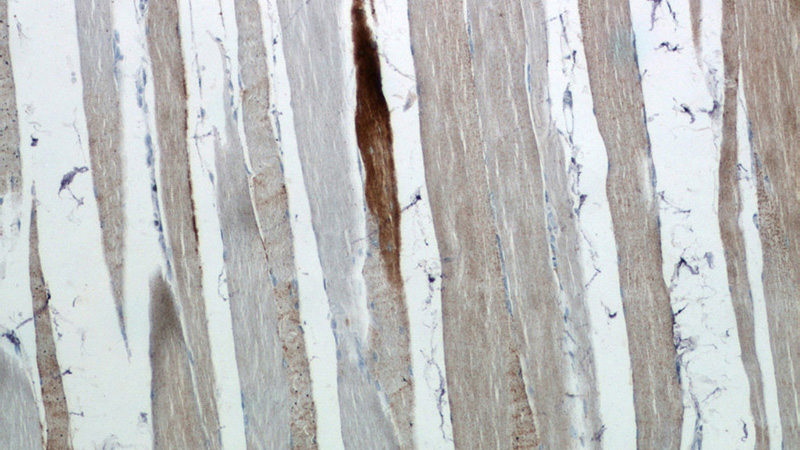 Immunohistochemistry of paraffin-embedded human skeletal muscle tissue slide using Catalog No:112445(MARCH5 Antibody) at dilution of 1:50 (under 10x lens)