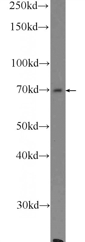 mouse liver tissue were subjected to SDS PAGE followed by western blot with Catalog No:107916(AGBL3 Antibody) at dilution of 1:300