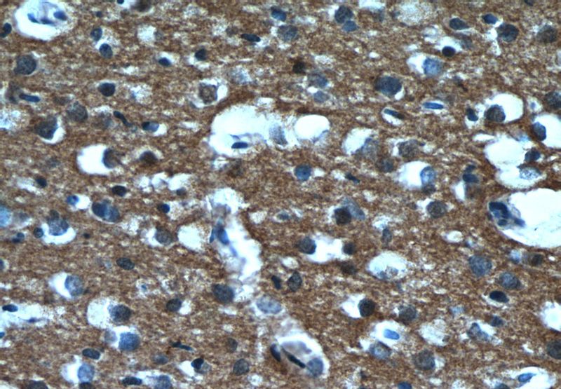 Immunohistochemistry of paraffin-embedded human brain tissue slide using Catalog No:107271(PTPRN Antibody) at dilution of 1:50 (under 40x lens)