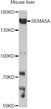 Western blot - SEMA5A Polyclonal Antibody 
