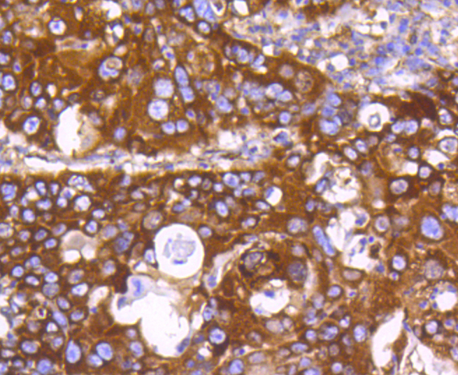 Immunohistochemistry - EGLN2 Monoclonal Antibody 
