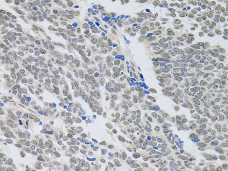 Immunohistochemistry - PAX3 Polyclonal Antibody 