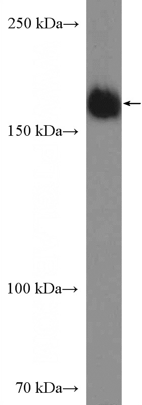 HeLa cells were subjected to SDS PAGE followed by western blot with Catalog No:116250(TOPBP1 Antibody) at dilution of 1:600