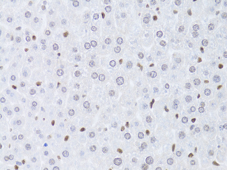 Immunohistochemistry - LMNB2 Polyclonal Antibody 