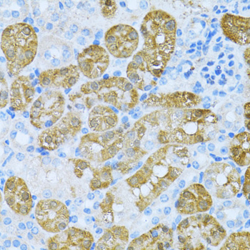 Immunohistochemistry - KLHL42 Polyclonal Antibody 