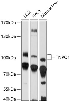 Western blot - TNPO1 Polyclonal Antibody 