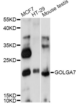 Western blot - GOLGA7 Polyclonal Antibody 