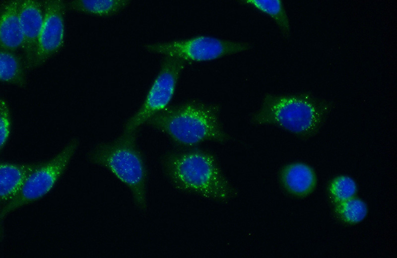 Immunofluorescent analysis of (-20oc Ethanol) fixed HeLa cells using Catalog No:107556(ABCD1 Antibody) at dilution of 1:50 and Alexa Fluor 488-congugated AffiniPure Goat Anti-Rabbit IgG(H+L)