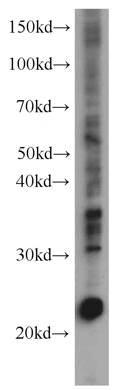 K-562 cells were subjected to SDS PAGE followed by western blot with Catalog No:107469(phospho(403/404)-TDP43 antibody) at dilution of 1:1000