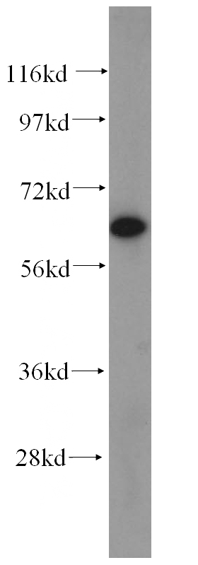 human heart tissue were subjected to SDS PAGE followed by western blot with Catalog No:109570(DPYSL2 antibody) at dilution of 1:300