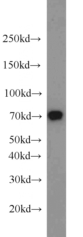HeLa cells were subjected to SDS PAGE followed by western blot with Catalog No:111304(HEXIM1 antibody) at dilution of 1:1500