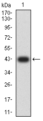 Fig1: Western blot analysis of KMT2D against human KMT2D (AA: 445-599) recombinant protein. Proteins were transferred to a PVDF membrane and blocked with 5% BSA in PBS for 1 hour at room temperature. The primary antibody ( 1/500) was used in 5% BSA at room temperature for 2 hours. Goat Anti-Mouse IgG - HRP Secondary Antibody at 1:5,000 dilution was used for 1 hour at room temperature.