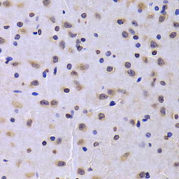 Immunohistochemistry - NUDC Polyclonal Antibody 