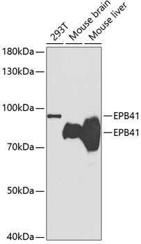 Western blot - EPB41 Polyclonal Antibody 
