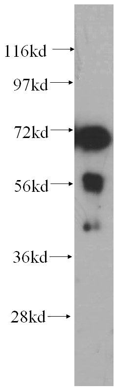 mouse heart tissue were subjected to SDS PAGE followed by western blot with Catalog No:113476(PABPC4 antibody) at dilution of 1:400
