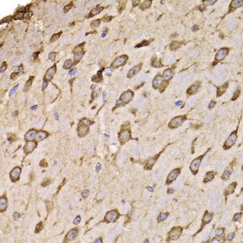 Immunohistochemistry - RPS14 Polyclonal Antibody 