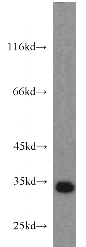 HeLa cells were subjected to SDS PAGE followed by western blot with Catalog No:115165(CCDC101 antibody) at dilution of 1:1000