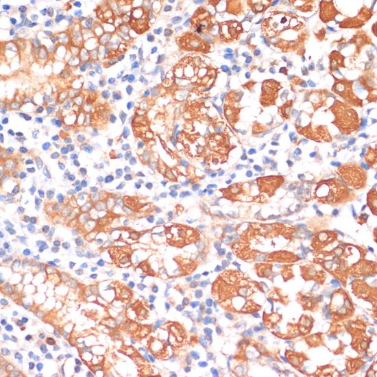 Immunohistochemistry - HHLA2 Polyclonal Antibody 