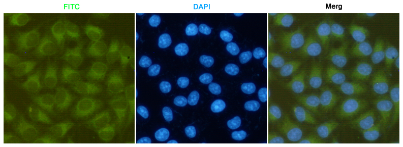 Immunofluorescent analysis of Hela cells fixed fixed by anhydrous methanol at -20u2103 and using FAK mouse mAb (dilution 1:200).