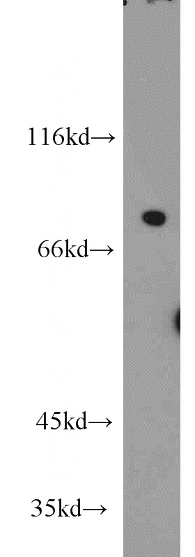 mouse brain tissue were subjected to SDS PAGE followed by western blot with Catalog No:113039(NCKIPSD antibody) at dilution of 1:500