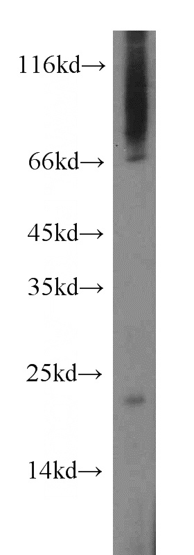 mouse lung tissue were subjected to SDS PAGE followed by western blot with Catalog No:108156(ARL6IP1 antibody) at dilution of 1:300