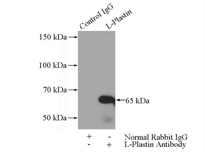 IP Result of anti-LCP1 (IP:Catalog No:112306, 4ug; Detection:Catalog No:112306 1:1000) with Jurkat cells lysate 2400ug.