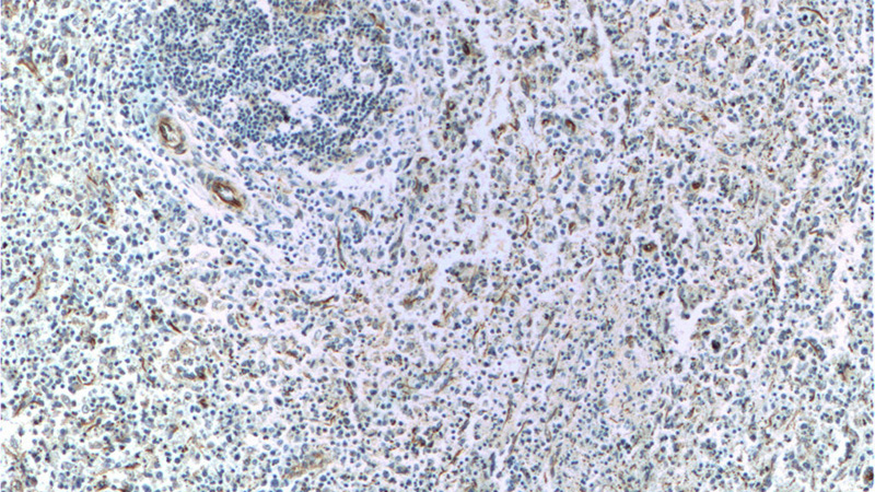 Immunohistochemistry of paraffin-embedded human spleen tissue slide using Catalog No:116725(VCAM-1 Antibody) at dilution of 1:50 (under 10x lens)