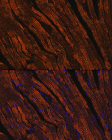 Immunofluorescence - MYH6 Polyclonal Antibody 