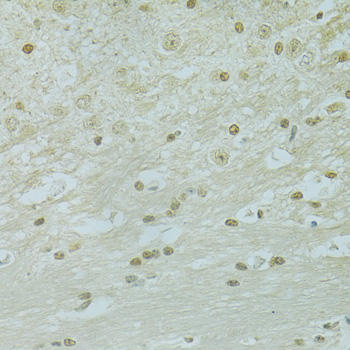 Immunohistochemistry - RCC1 Polyclonal Antibody 