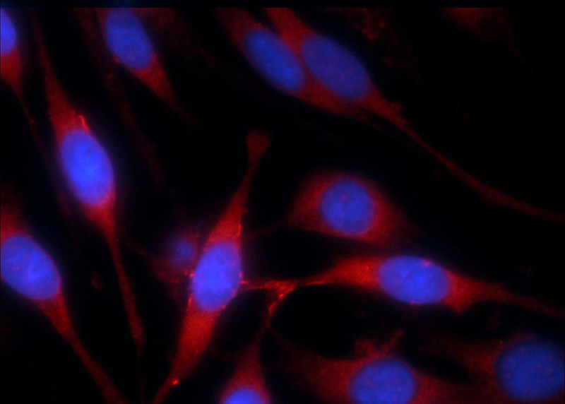 Immunofluorescent analysis of C6 cells using Catalog No:112680(KIAA1804 Antibody) at dilution of 1:25 and Rhodamine-Goat anti-Rabbit IgG
