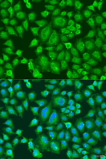 Immunofluorescence - PARL Polyclonal Antibody 