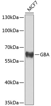 Western blot - GBA Polyclonal Antibody 
