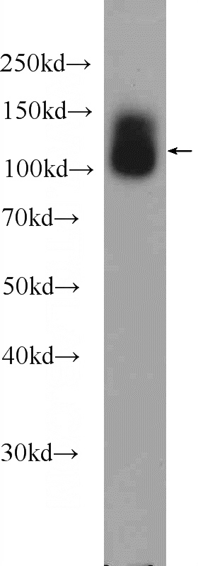 fetal human brain tissue were subjected to SDS PAGE followed by western blot with Catalog No:116097(TMEM132A Antibody) at dilution of 1:300