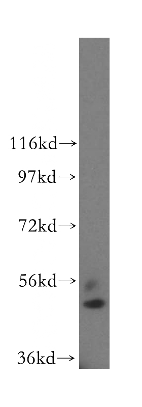 human kidney tissue were subjected to SDS PAGE followed by western blot with Catalog No:117140(BHMT antibody) at dilution of 1:2000