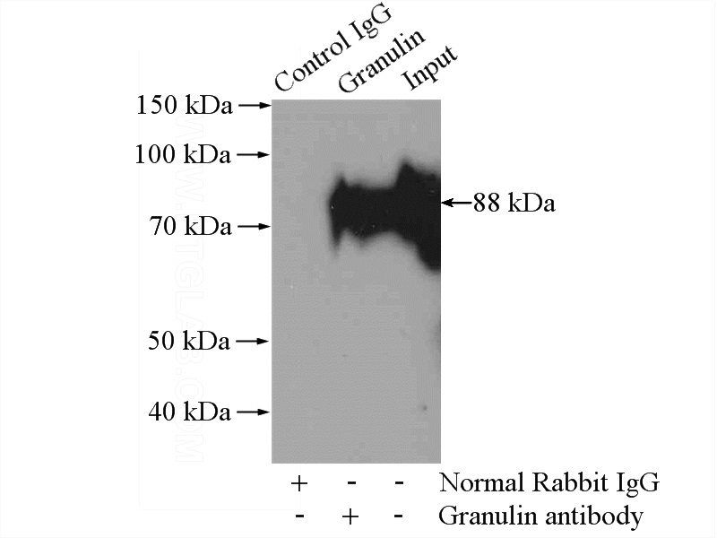 IP Result of anti-PCDGF,GRN (IP:Catalog No:111159, 4ug; Detection:Catalog No:111159 1:800) with mouse kidney tissue lysate 4000ug.