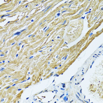 Immunohistochemistry - SLC5A6 Polyclonal Antibody 