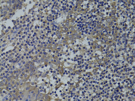 Immunohistochemistry - GNA15 Polyclonal Antibody 