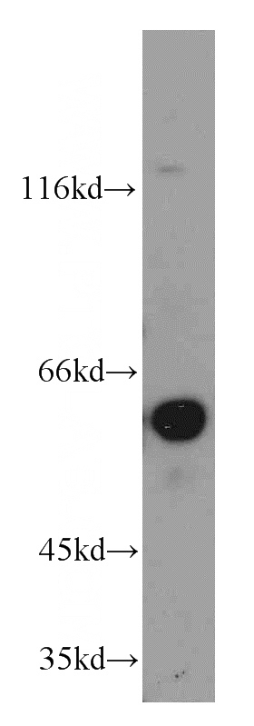 mouse lung tissue were subjected to SDS PAGE followed by western blot with Catalog No:113118(NTNG1 antibody) at dilution of 1:500