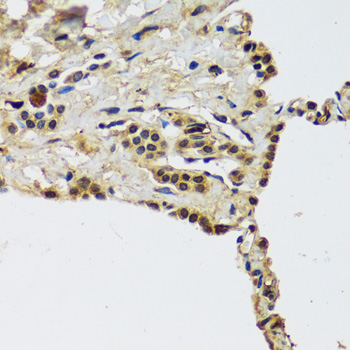 Immunohistochemistry - CCDC59 Polyclonal Antibody 