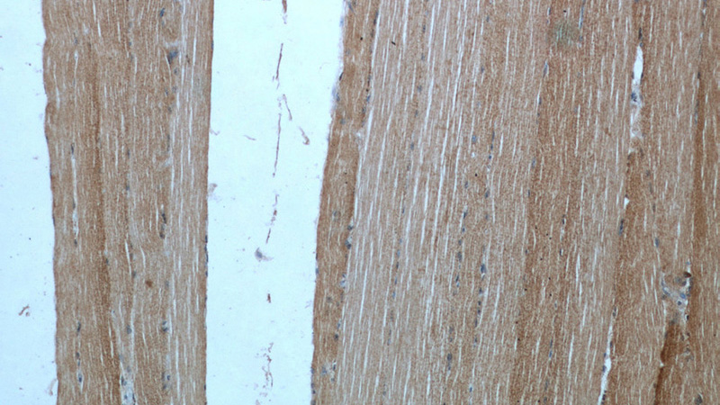 Immunohistochemical of paraffin-embedded human skeletal muscle using Catalog No:110384(EFNA3 antibody) at dilution of 1:50 (under 10x lens)
