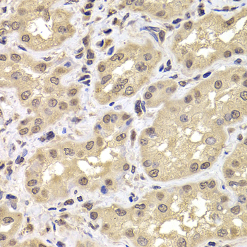Immunohistochemistry - PSMD12 Polyclonal Antibody 