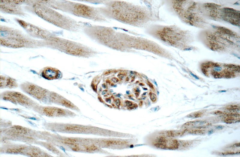 Immunohistochemistry of paraffin-embedded human heart tissue slide using Catalog No:107838(AGTR1 Antibody) at dilution of 1:50 (under 40x lens)