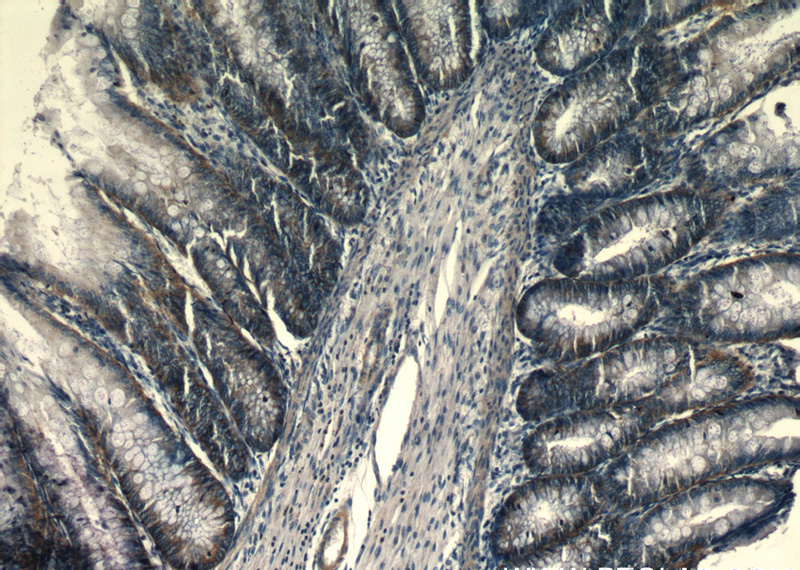 Immunohistochemical of paraffin-embedded human colon using Catalog No:114007(PLP2 antibody) at dilution of 1:50 (under 10x lens)