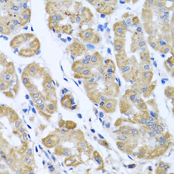 Immunohistochemistry - EIF2S3 Polyclonal Antibody 