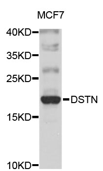 Western blot - DSTN Polyclonal Antibody 