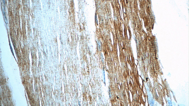 Immunohistochemistry of paraffin-embedded human skeletal muscle tissue slide using Catalog No:116551(UFD1L Antibody) at dilution of 1:50 (under 40x lens)