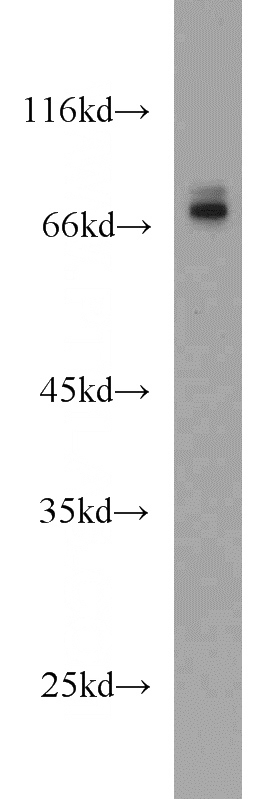 mouse liver tissue were subjected to SDS PAGE followed by western blot with Catalog No:109097(CDC25B antibody) at dilution of 1:300