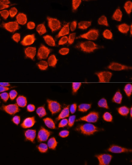 Immunofluorescence - AADAC Polyclonal Antibody 